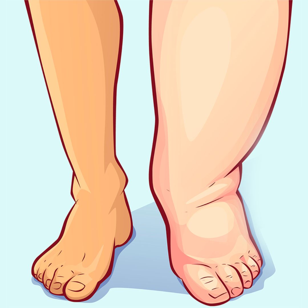 Akusoli - Shoe Insoles — view 2