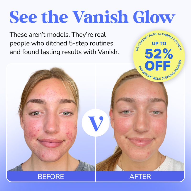 Vanish DrySerum before-and-after results