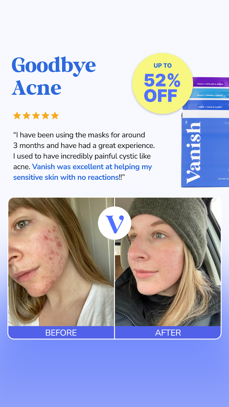 Vanish DrySerum before-and-after results