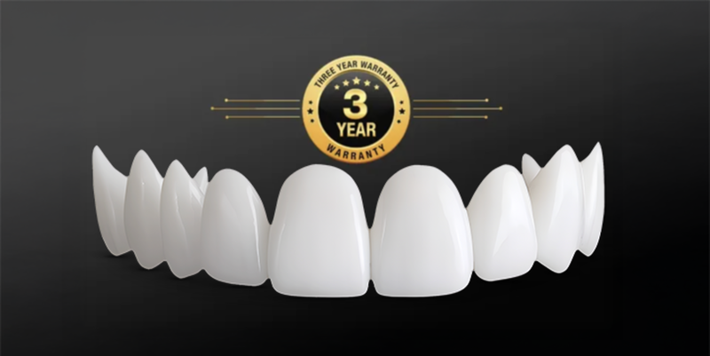 Shiny Smile Veneers in action — demo view 1