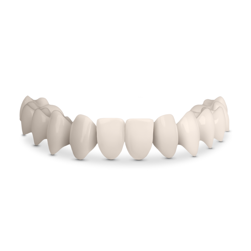 Shiny Smile Veneers close-up detail