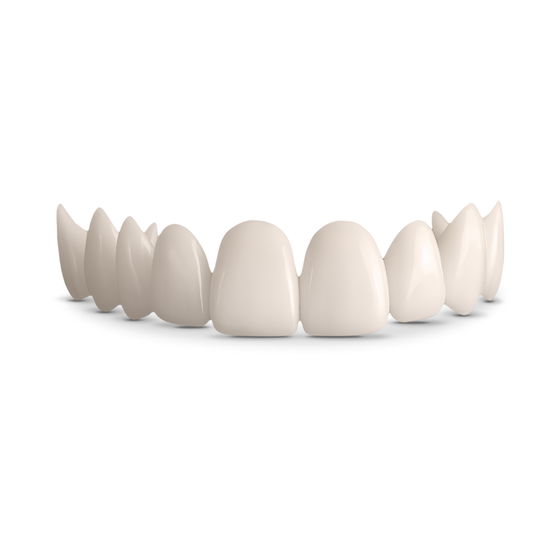 Shiny Smile Veneers — view 5
