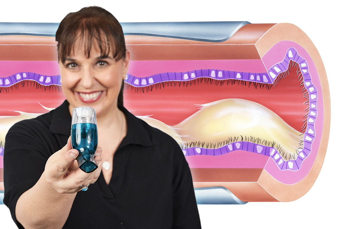 AirPhysio OPEP Technology — How It Clears Airways Woman holding AirPhysio device with anatomical cross-section illustration showing airway clearance