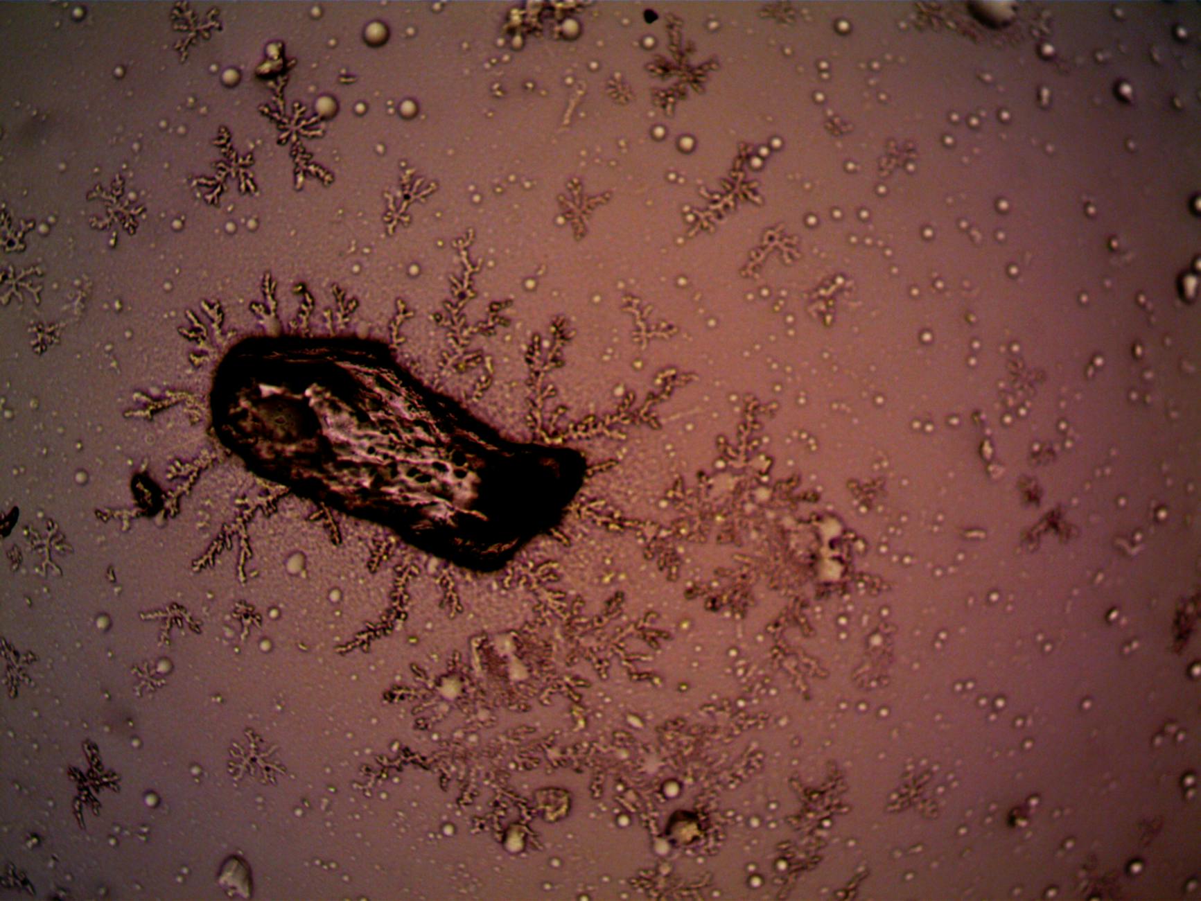 Microscopic view of bacteria and crystal formations illustrating microbial growth on surfaces