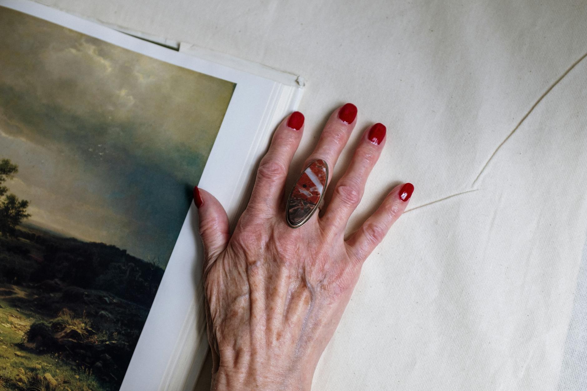 Senior woman's hand and arm showing natural skin aging, relevant to understanding crepey skin treatment for arms
