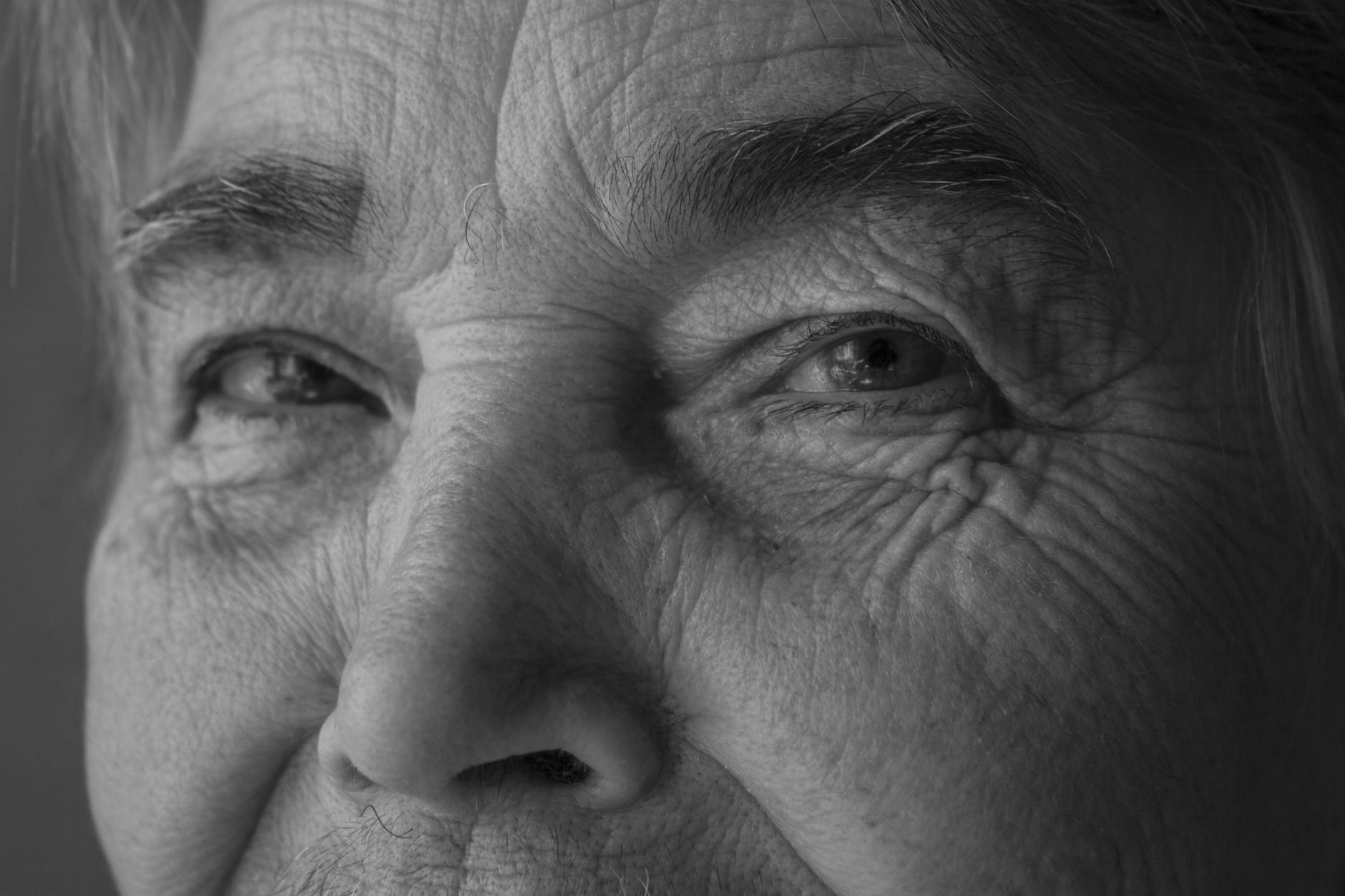 Crow's Feet: What Causes Them and 9 Evidence-Based Ways to Reduce Them