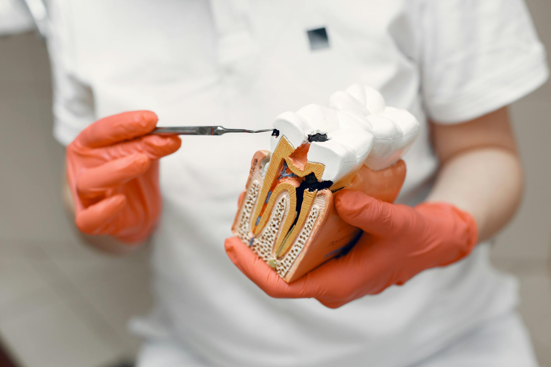 10 Early Warning Signs of Tooth Decay You Shouldn't Ignore