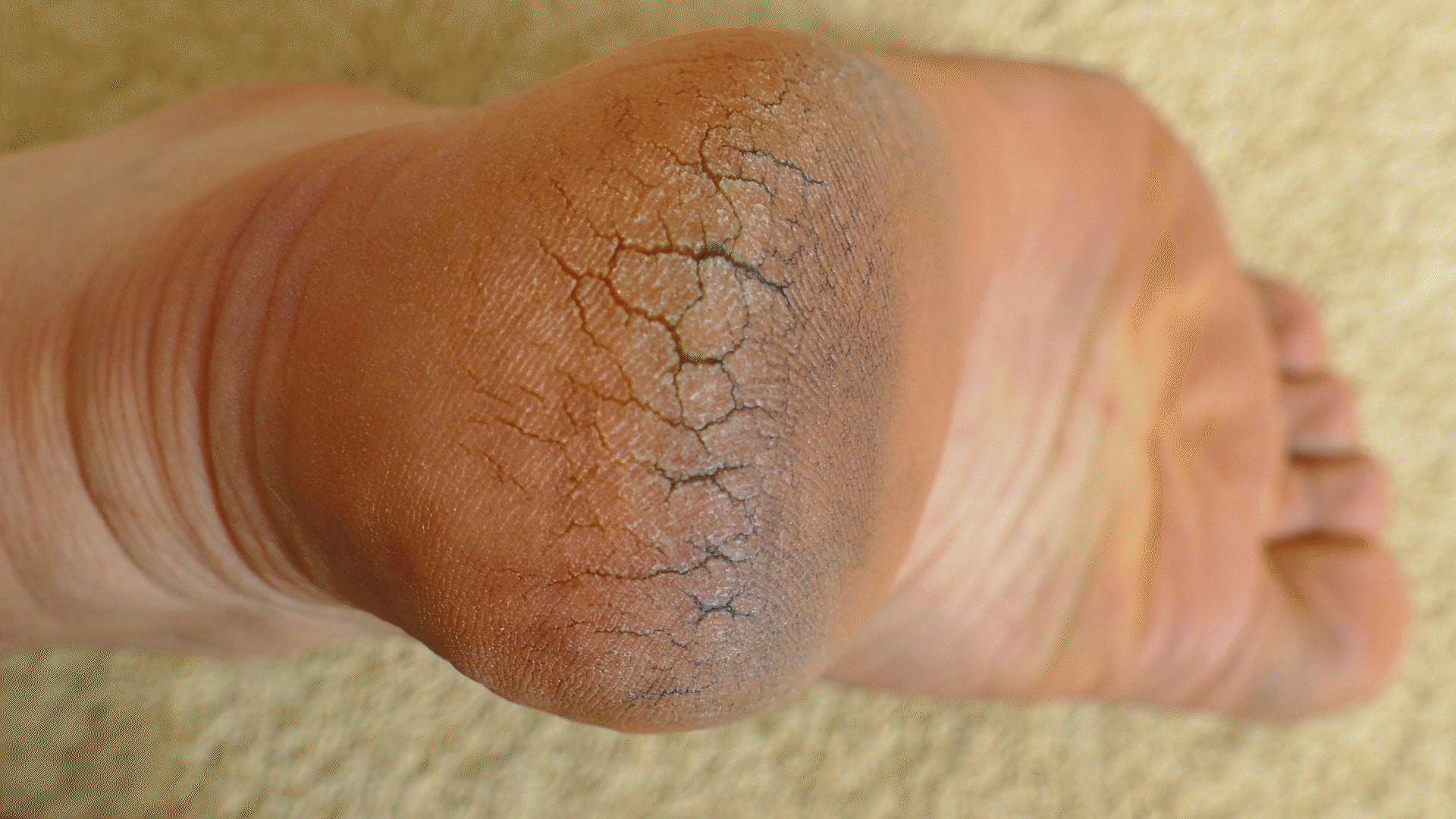 FEETS Foot Peel Mask Review 2026: We Tested It for 10 Days