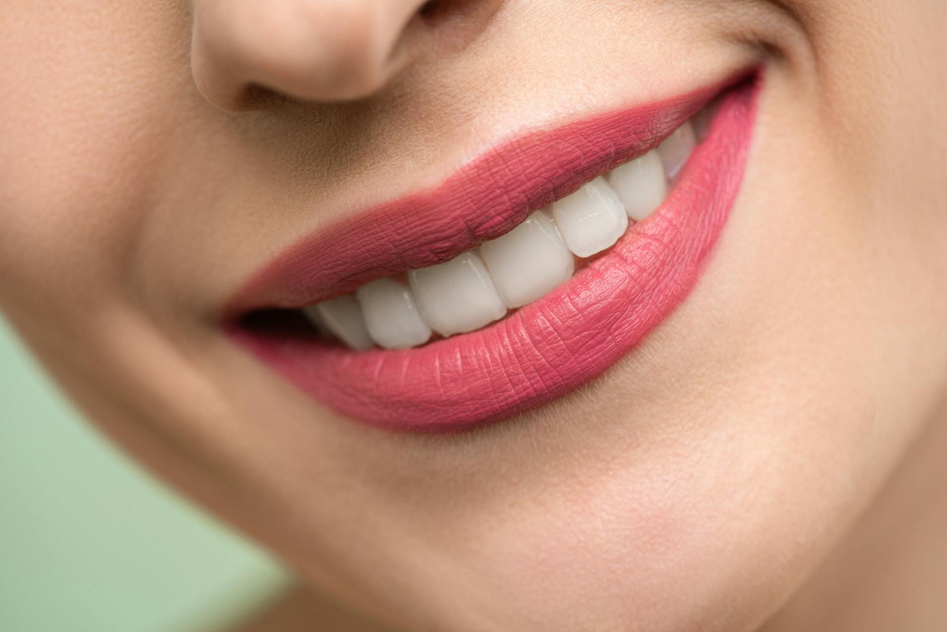 Close-up of a woman's bright white smile — the goal of understanding what causes yellow teeth