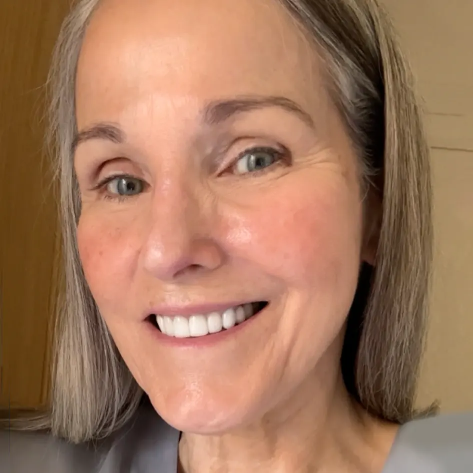 Glamory MicroLift System customer review — Melissa's 30-day results and testimonial