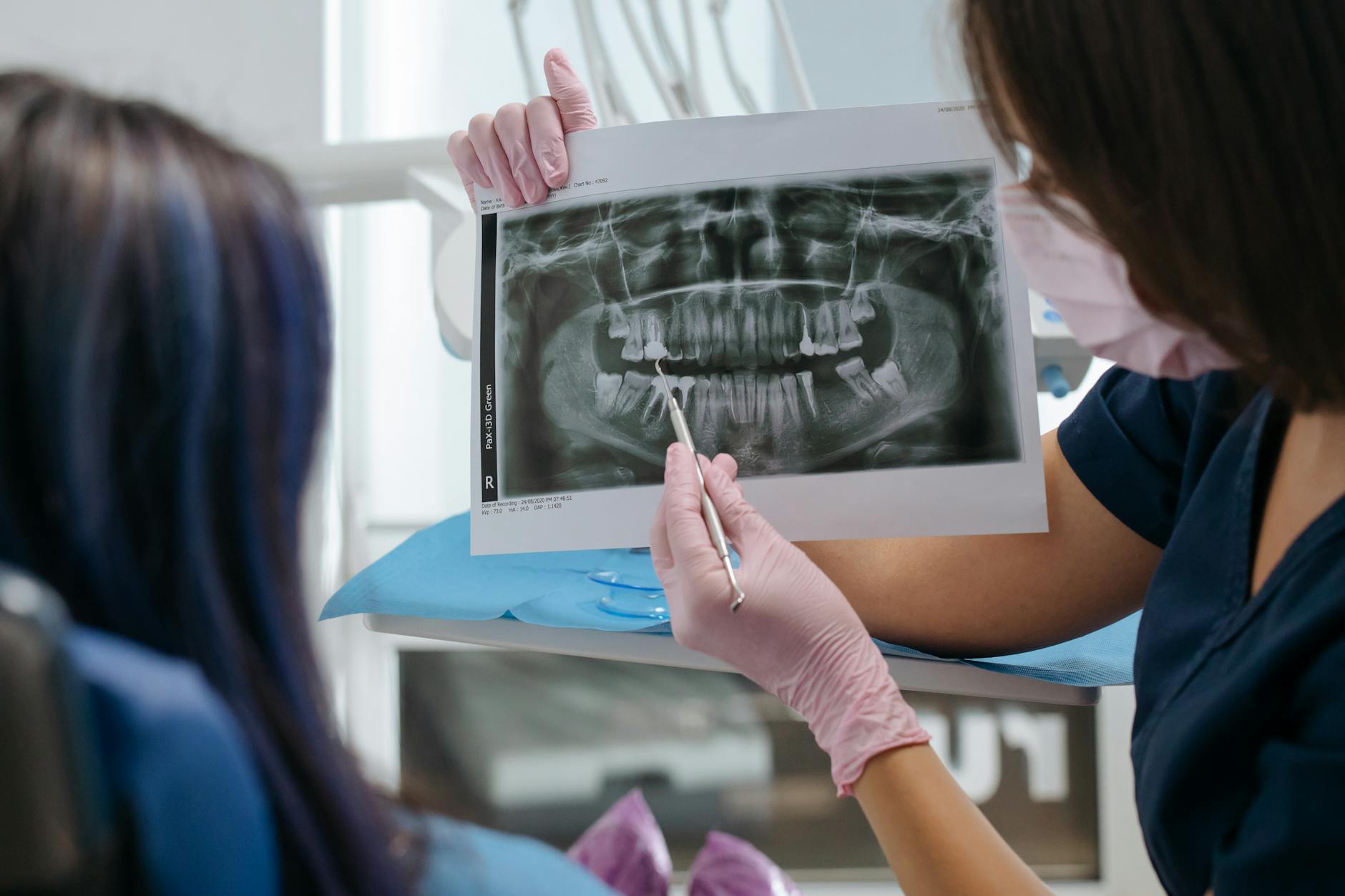 Gum Disease Stages: Early Warning Signs You Should Never Ignore