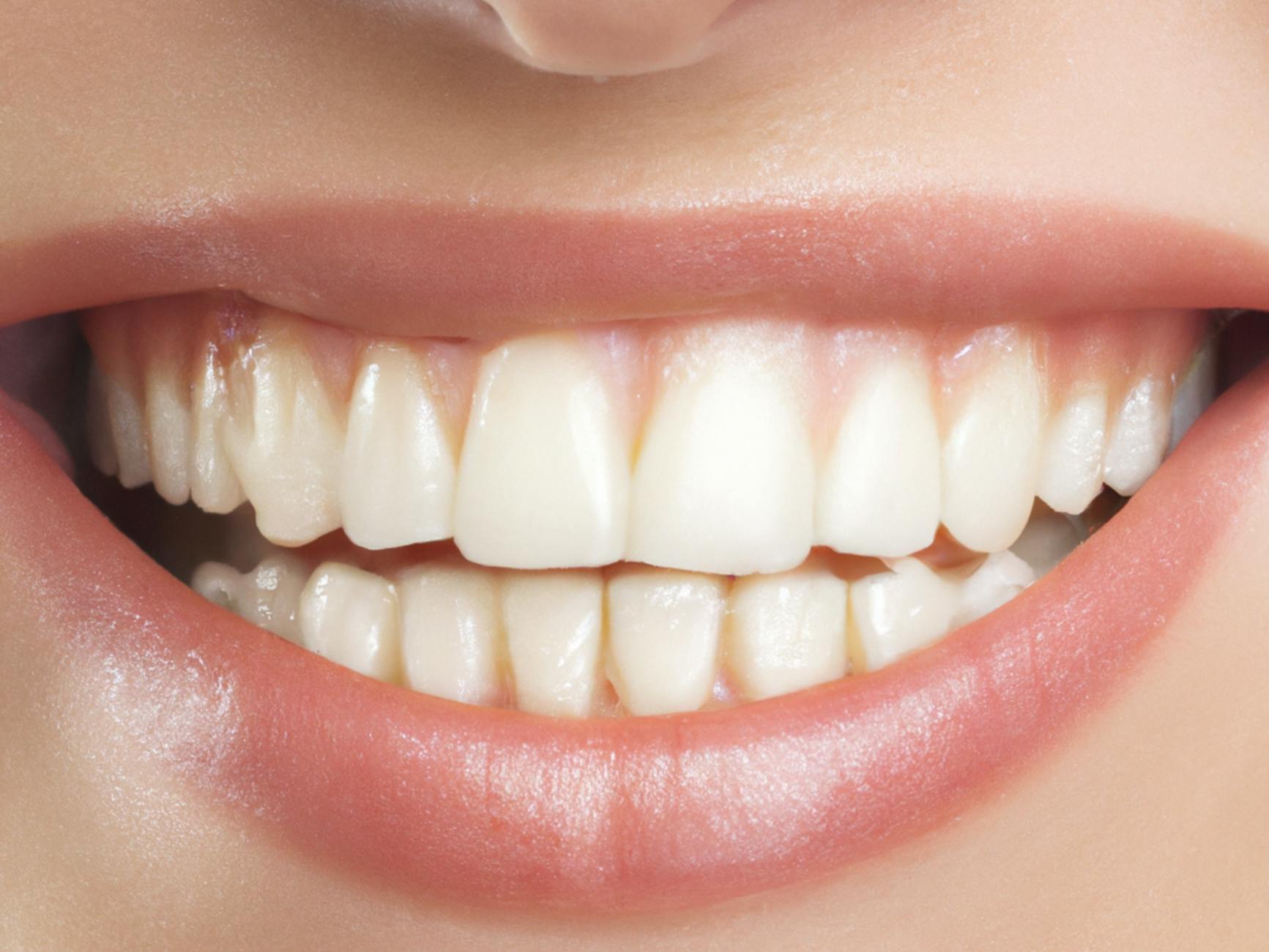 Close-up of clean, healthy white teeth after effective plaque removal routine