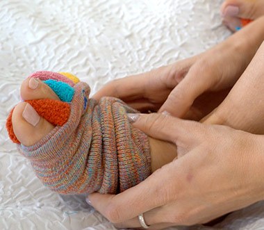 My Happy Feet alignment socks worn on feet showing individual toe pockets