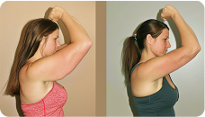 MyoGlow Review 2026: We Tested the Arm Sculpting Device for 30 Days — Here's What Happened