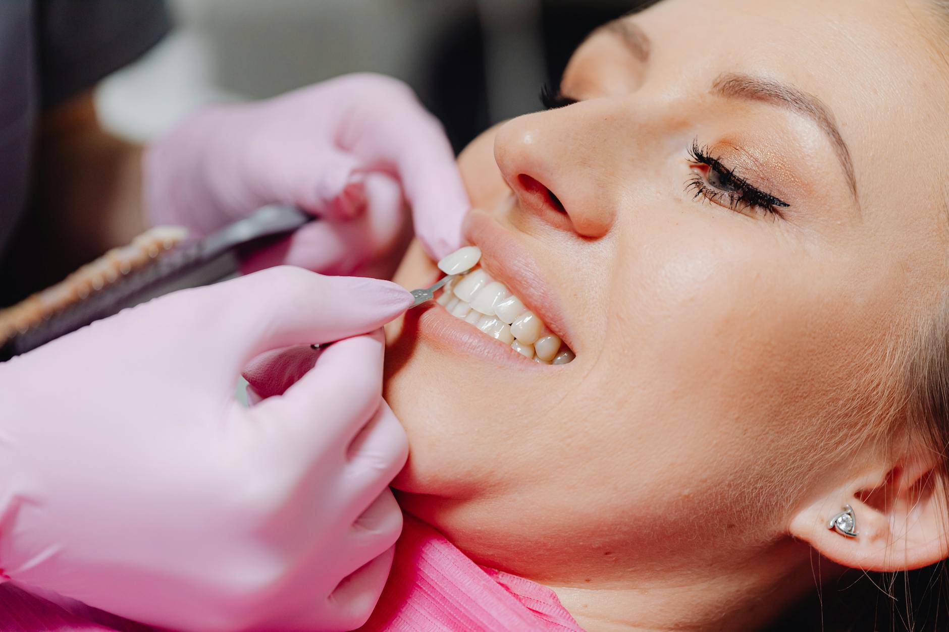 Close-up of a dental whitening procedure being performed at a dentist office