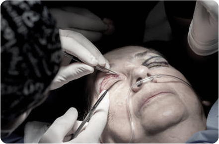 Renewa EyeLift lifestyle shot showing the device being used at home