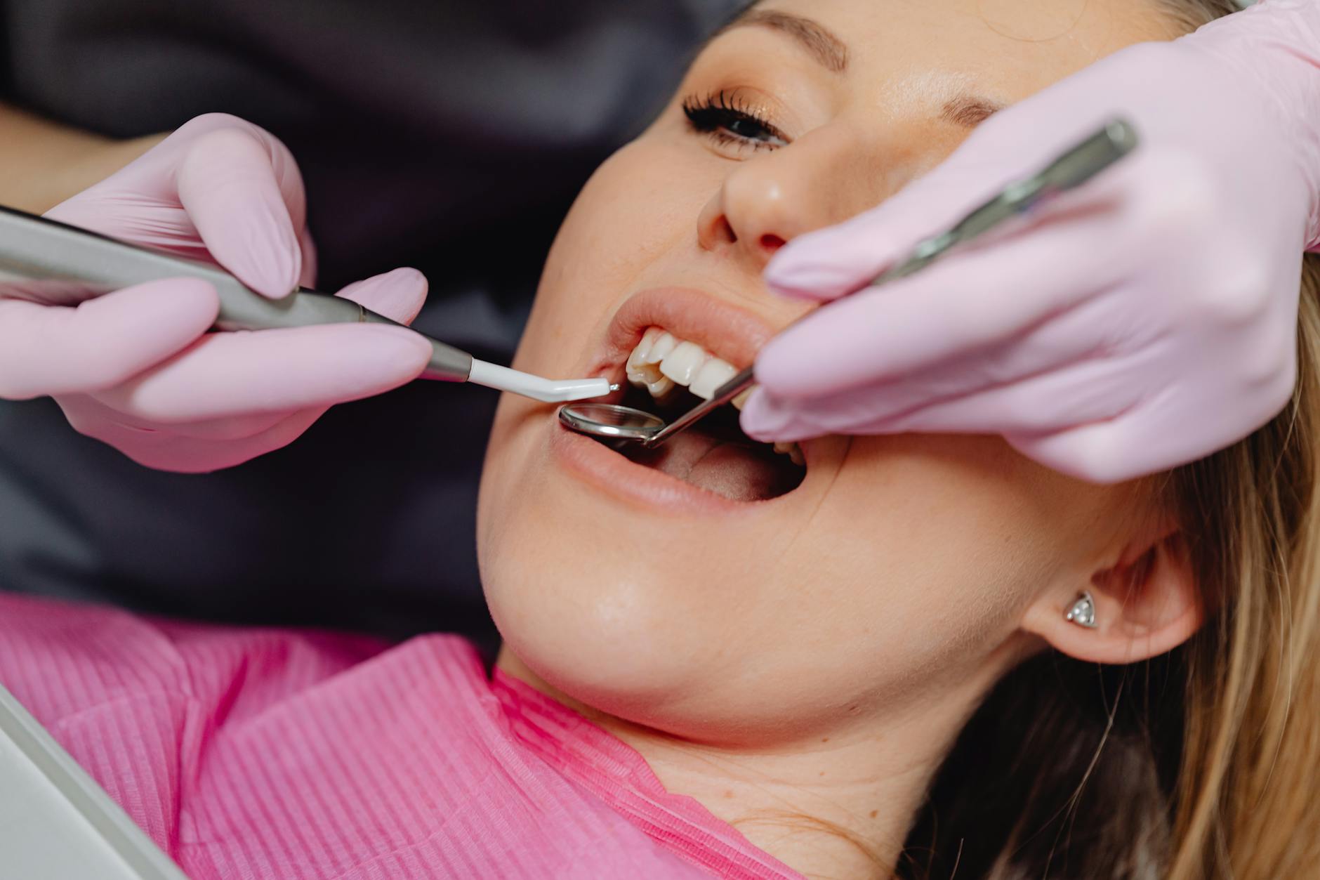Dental professional performing a tooth treatment in a clinic setting
