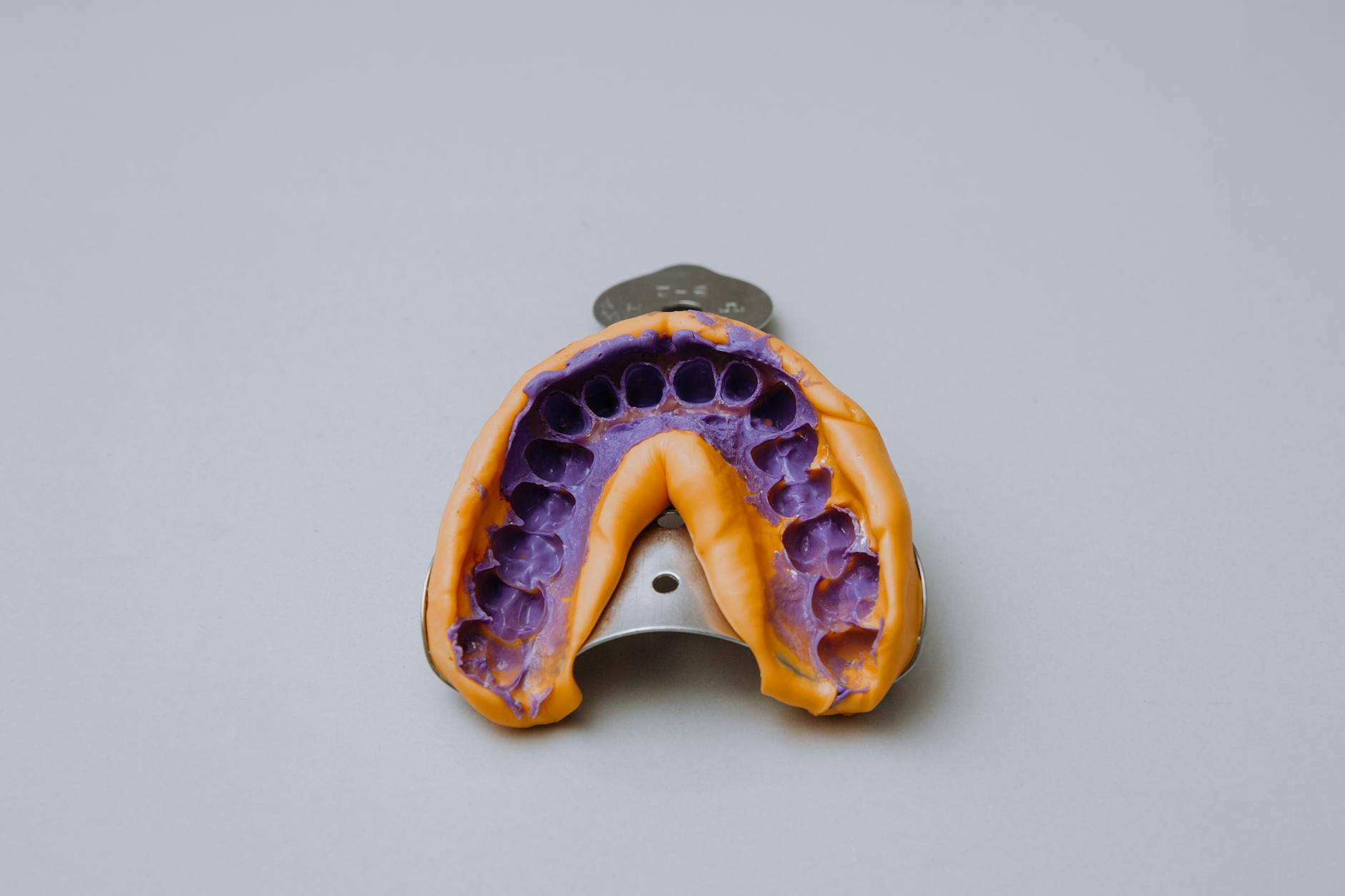 Dental impression tray with purple molding material used to create custom snap-on veneers