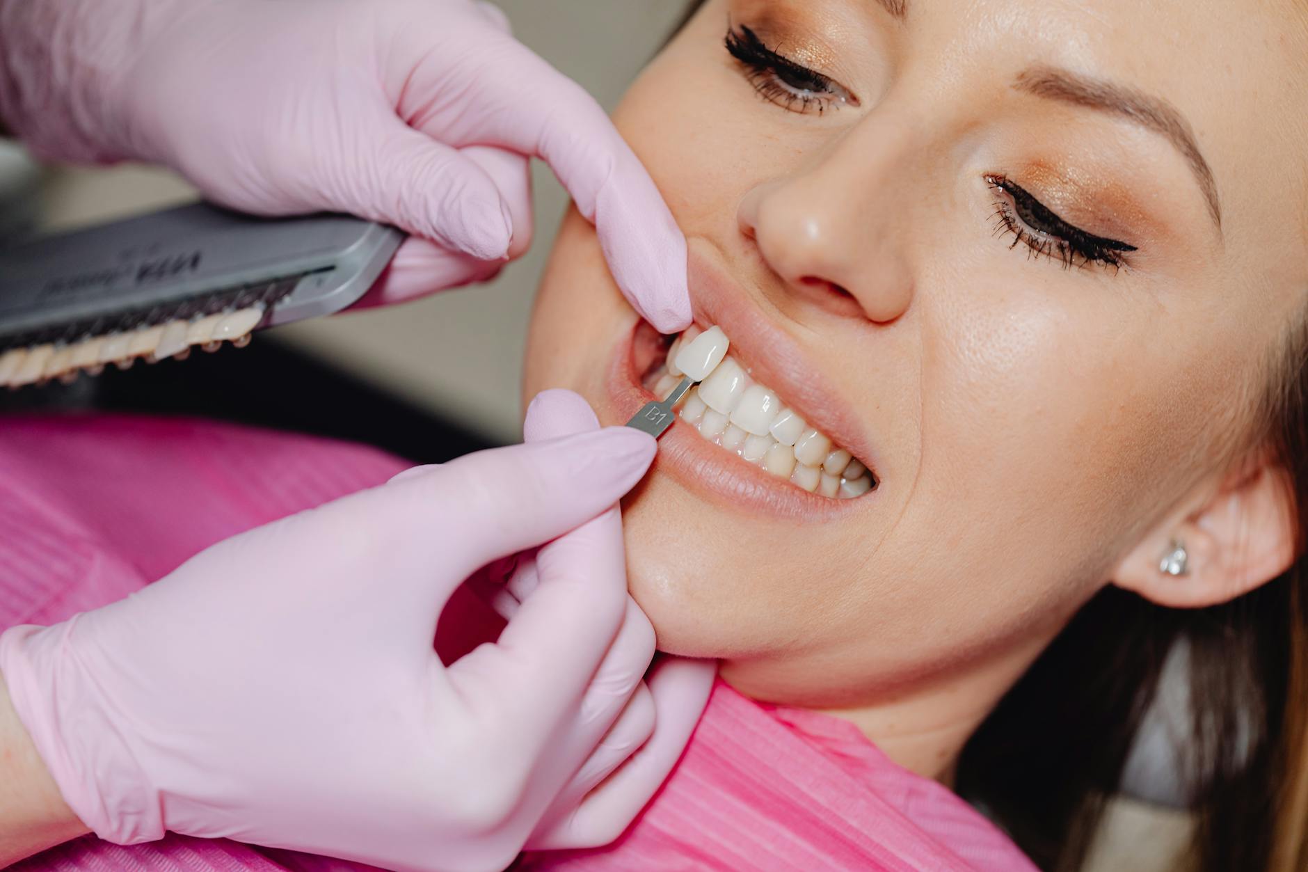 Close-up of a dental veneer being evaluated at a dental clinic