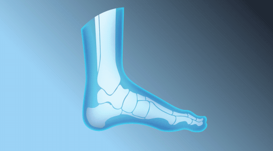 Soul Insole Review 2026: We Tested It for 30 Days So You Don't Have To